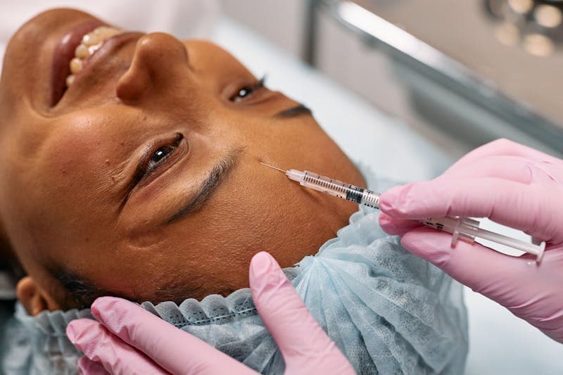 Understanding Bio-Stimulators: Sculptra and Radiesse Explained